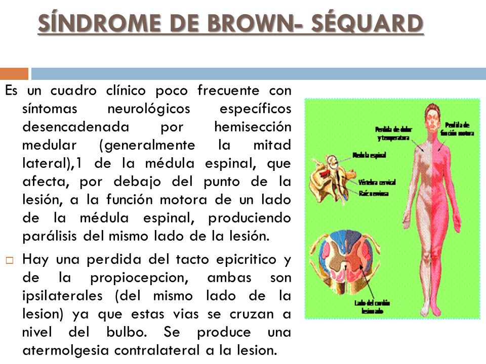 síndrome de brown sequard fisiopatología de la diabetes